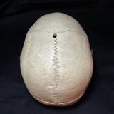 Item 5. Human medical skull