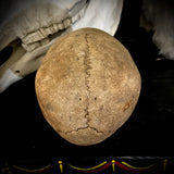 Human skull
