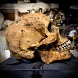 Human skull with mandible