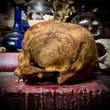 Human skull