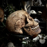 A human skull with mandible