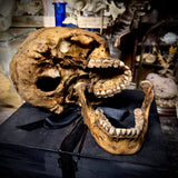 Human skull with mandible