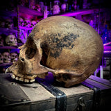 Human skull