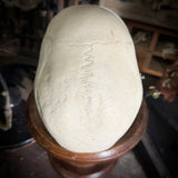 Medically prepared human skull
