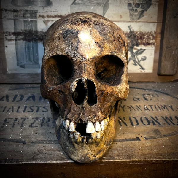 Human skull with mandible