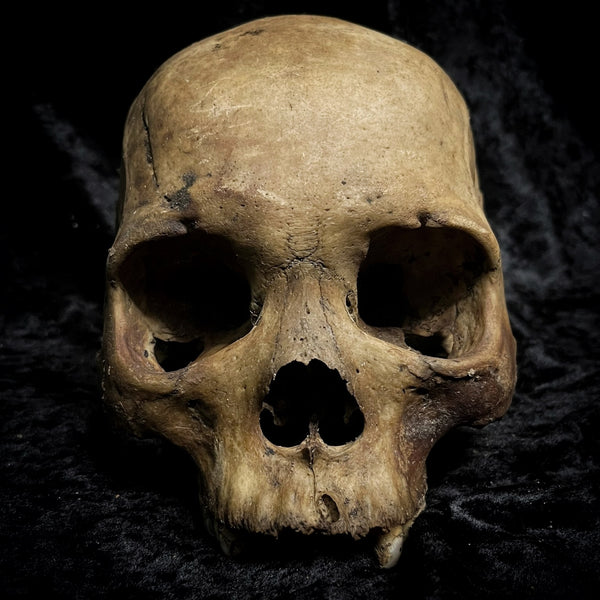 Human skull