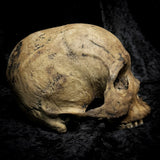 Human skull