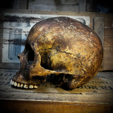 Human skull