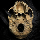 Human skull