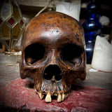 Human skull