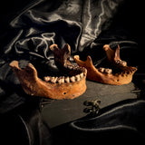 Item 10. Two human mandibles