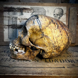 Human altar skull with mandible