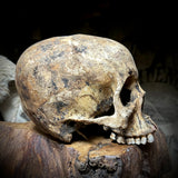 Human skull