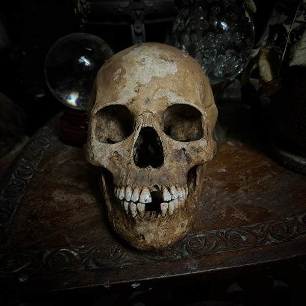 Human skull