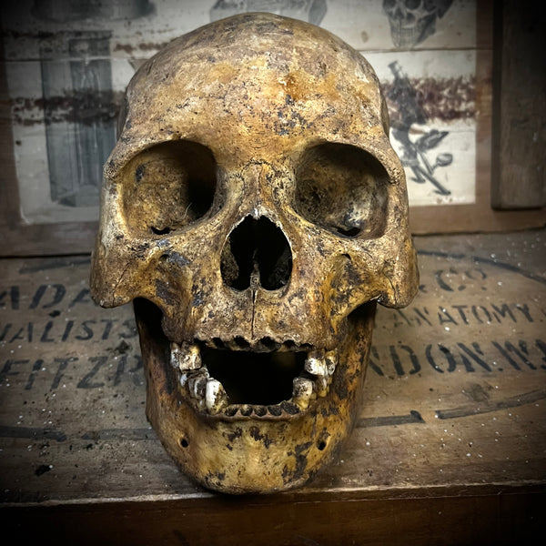 Human skull with mandible
