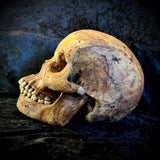 Item 4. Human skull with mandible