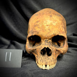 Item 11. Human skull