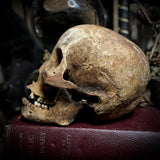 Human skull with mandible