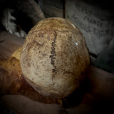 Human skull