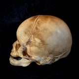 Item 1. Human fetal skull