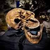 Human skull with mandible