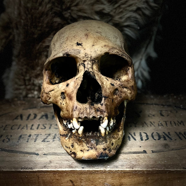Human skull with mandible