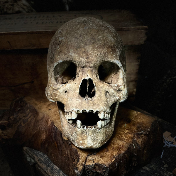 Large human skull with mandible