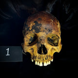 Item 1. Human skull