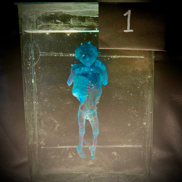 Item 1. Diaphonized human fetus