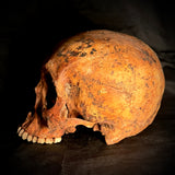 Item 7. Human skull