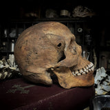 Human skull