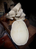 Medically prepared human skull