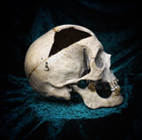Medically prepared human skull