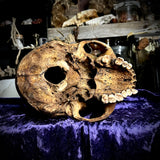 Human skull