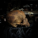 Human skull
