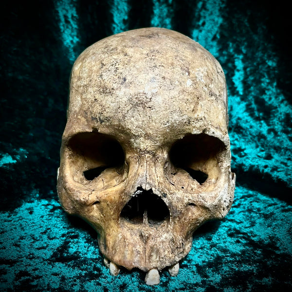 Human skull *COMPETITION*
