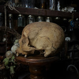 Human skull