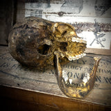 Human skull with mandible