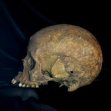 Item 1. Human skull