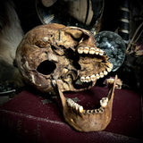 Human skull with mandible