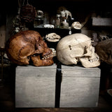 Human skull OR Mystery box