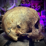 Human skull