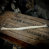 Human fibula (lower leg bone)