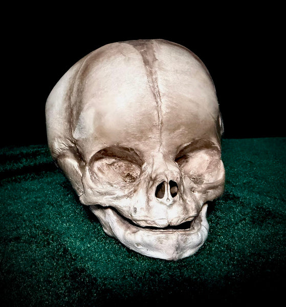 Human fetal skull