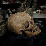 Human skull