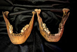 Item 13. Two human mandibles