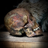 Human skull with mandible
