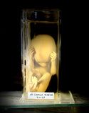 Foetal specimen