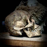 Human skull with mandible.