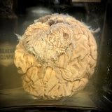 A human brain